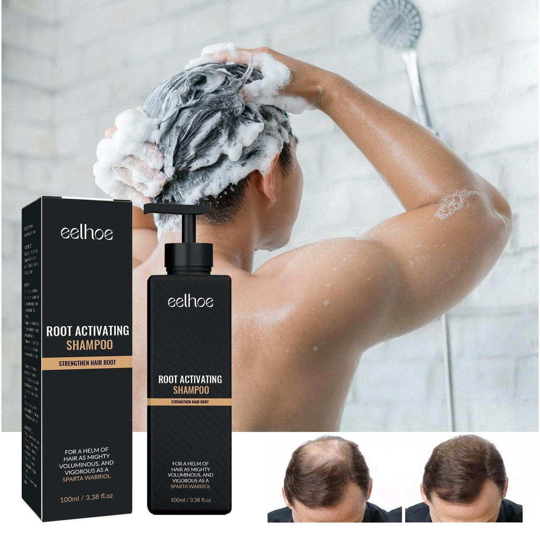 Man applying Root Activator Shampoo with foam in shower, product packaging and before-after hair growth comparison images.