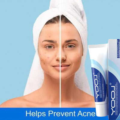 Retinol Vitamin A gel moisturizing facial cream for acne prevention and skin improvement.